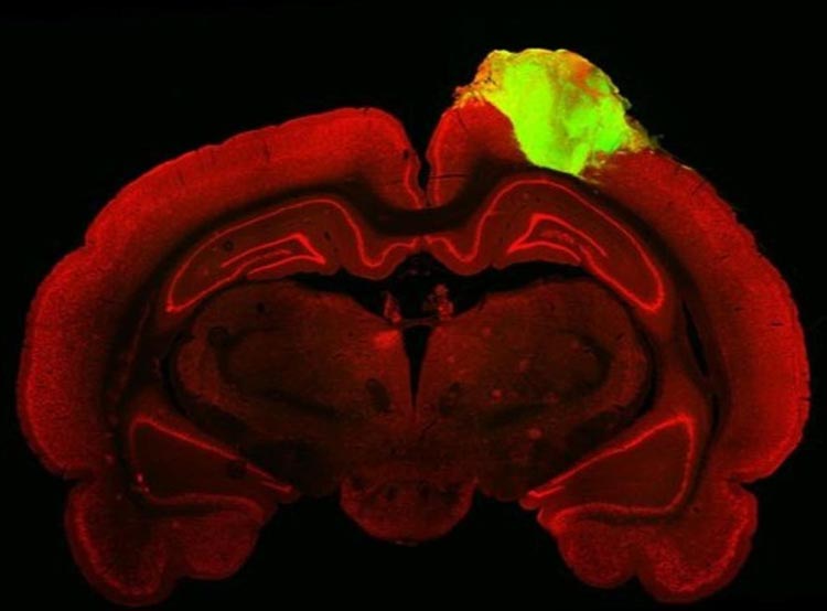 محققان برای درمان نابینایی بخشی از مغز انسان را به موش پیوند زدند - تی ام گیم
