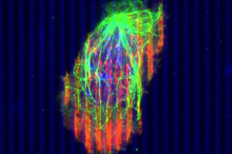 محققان سلول‌های ایمنی را برای مبارزه با تومورها مهندسی می‌کنند