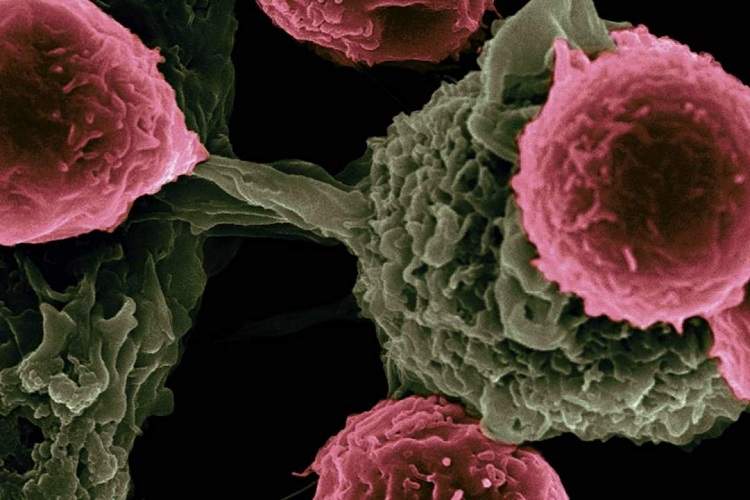 تزریق باکتریهای مرده به تومورها راهی نویدبخش برای درمان سرطان است