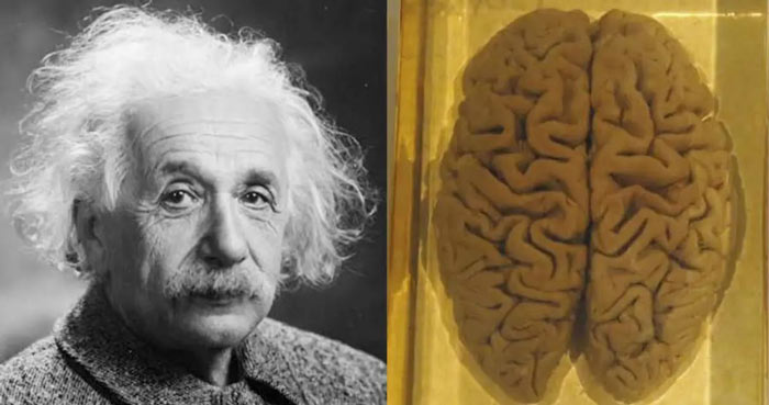 مغز شگفت‌انگیز انیشتین