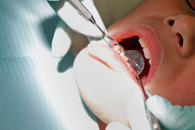 وضعیت سلامت دهان و دندان بر مغز اثر می‌گذارد