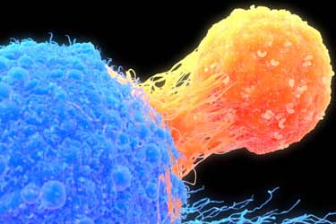 چرا سیستم ایمنی بدن نمی‌تواند سلول‌های سرطانی را از بین ببرد؟