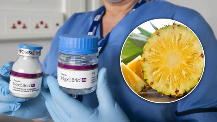 درمان سوختگی با آناناس؛ راه جدید مراقبت از زخم