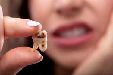 چرا دندان عقل درمی‌آوریم؟