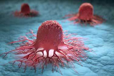 روش جدیدی که ۹۹ درصد از سلول‌های سرطانی را از بین می‌برد!
