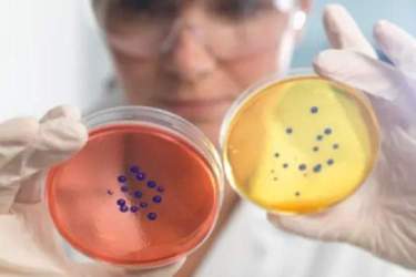 کشف کلاس جدیدی از آنتی‌بیوتیک‌ها که ابرمیکروب مرگبار مقاوم به دارو را از بین می‌برد